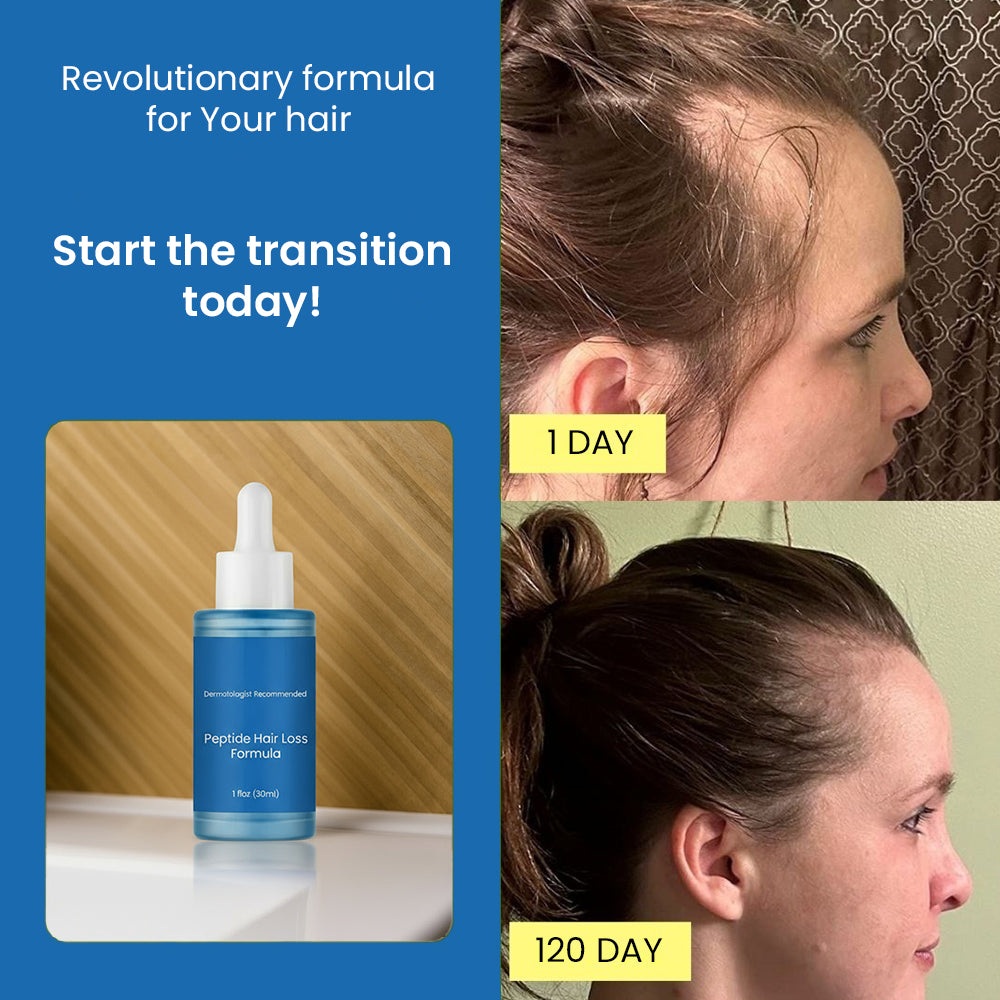 Clinical hair growth formula - Natalie